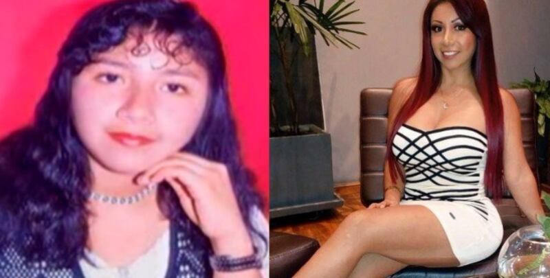 El antes y después de la exvedette Daisy Araujo
