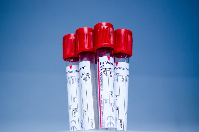 Tubos de ensayo para muestras de sangre en relación con la viruela del mono.