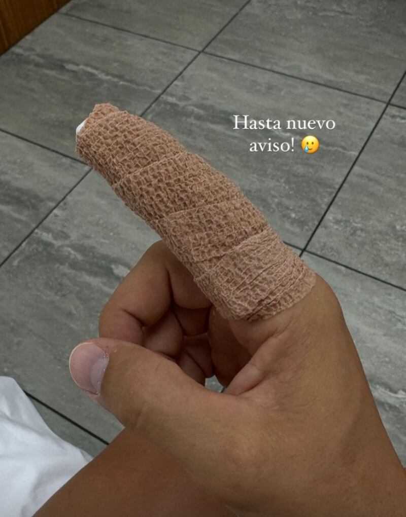 Hugo García mostró la lesión en su mano derecha.