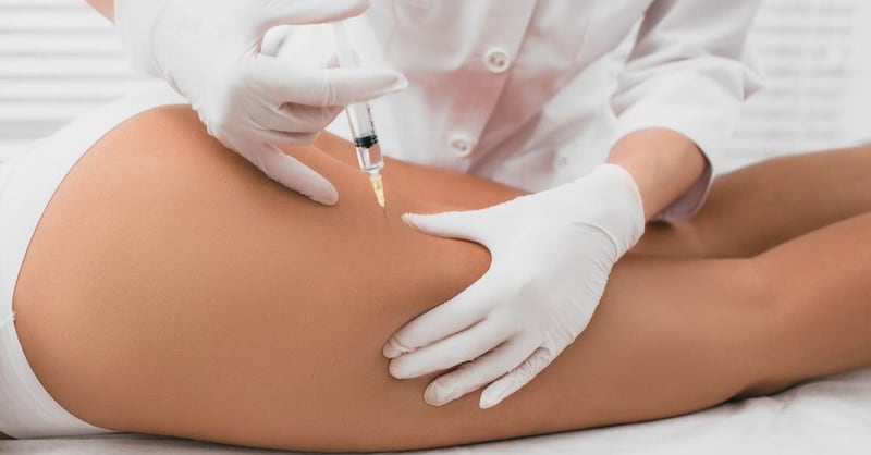 Para someterse a una mesoterapia lo recomendable es realizarse exámenes previos de sangre