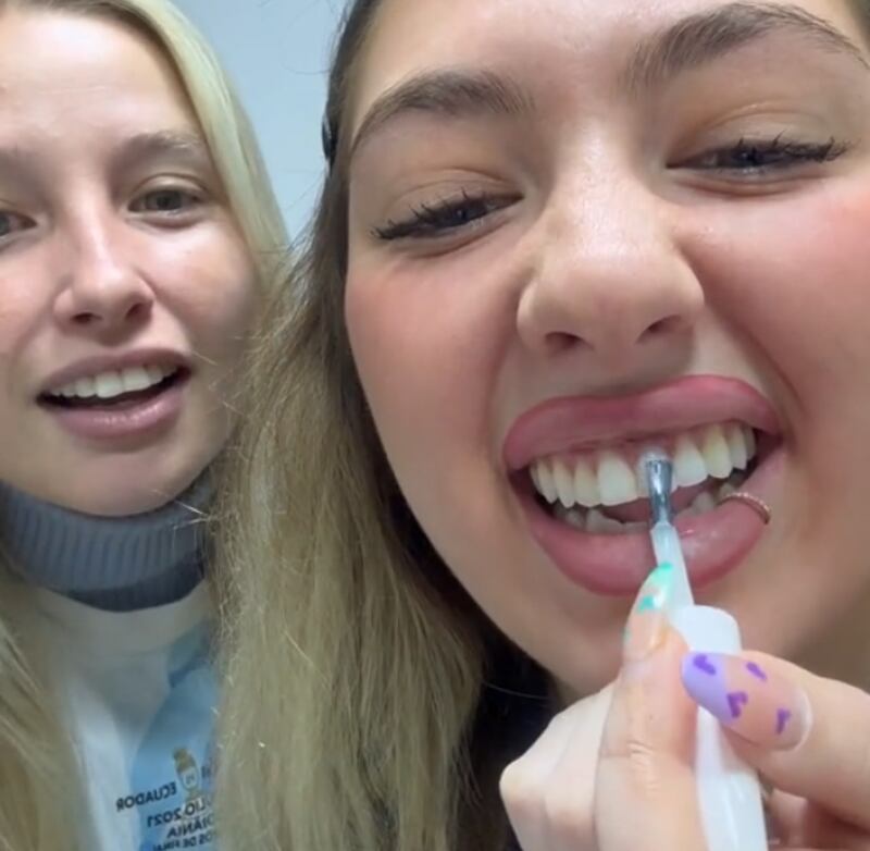 Influencer desata polémica con su truco para blanquear los dientes.